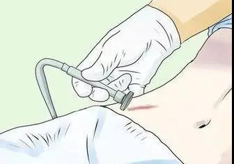 云南最权威的疤痕病医院